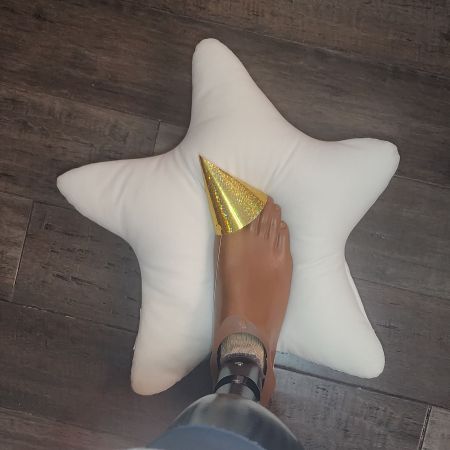 Prosthetic foot wearing a sparkly party hat